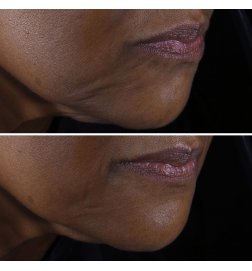 Smart Clinical Repair - Straffende Gesichts- und Halscreme